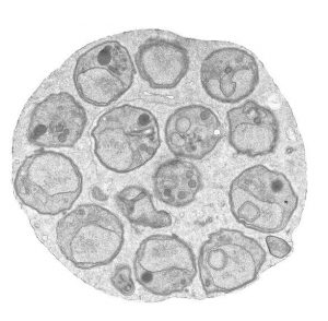 Plasmodium berghei schizont with merozoites - EM image (malaria parasite)